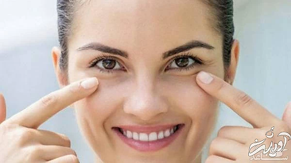 خانمی با چشم های پف دار